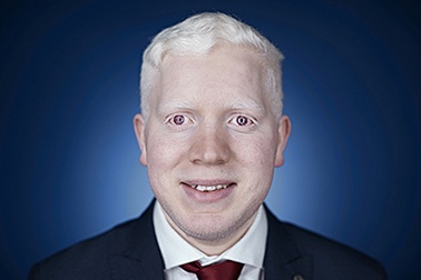 most albino siblings